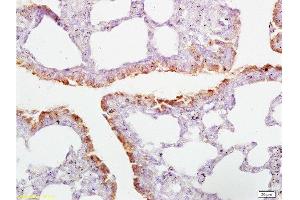 Formalin-fixed and paraffin embedded rat lung tissue labeled with Anti-CD2AP Polyclonal Antibody  , Unconjugated at 1:200, followed by conjugation to the secondary antibody and DAB staining (CD2AP 抗体  (AA 561-641))