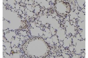 ABIN6278303 at 1/100 staining Mouse lung tissue by IHC-P. (Plakophilin 3 抗体  (C-Term))