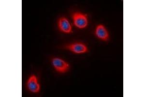 Immunofluorescent analysis of RPS6 staining in HeLa cells. (RPS6 抗体  (C-Term))