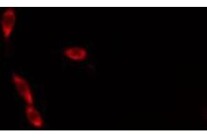 ABIN6276306 staining  Hela cells by IF/ICC. (Cytochrome C 抗体  (N-Term))