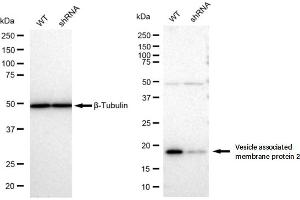 Western blotting analysis using Vesicle associated membrane protein 2 antibody (ABIN7800830). (Recombinant VAMP2 抗体)