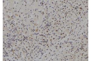 ABIN6257825 and ABIN6273704 at 1/100 staining Human liver tissue by IHC-P.