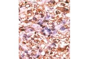 Image no. 2 for anti-Retinoblastoma 1 (RB1) (pSer788) antibody (ABIN358214) (Retinoblastoma 1 抗体  (pSer788))