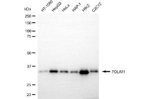 Western blotting analysis using PDLIM1 antibody (ABIN7799747).