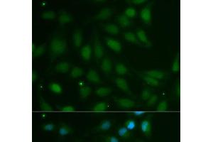 Immunofluorescence analysis of MCF-7 cells using ABO Polyclonal Antibody (ABO 抗体)