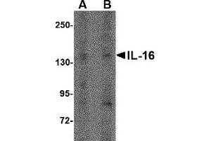 Western Blotting (WB) image for anti-Interleukin 16 (IL16) (N-Term) antibody (ABIN1031408) (IL16 抗体  (N-Term))