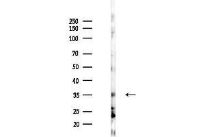 anti-ADP-Ribosylation Factor Interacting Protein 1 (ARFIP1) (Internal Region) antibody