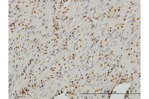 Immunostaining (ISt) image for anti-Stromal Antigen 1 (STAG1) (AA 1112-1221) antibody (ABIN564458)