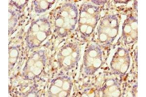 Immunohistochemistry of paraffin-embedded human colon tissue using ABIN7158817 at dilution of 1:100 (LYG1 抗体  (AA 20-194))