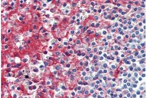 Anti-Collagen IV antibody IHC staining of human spleen. (Collagen IV 抗体)