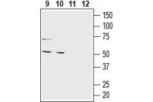 Western blot analysis of mouse colon (lanes 9 and 11) and human colorectal adenocarcinoma (Colo 205) cell line (lanes 10 and 12) lysates:9,10. (omega-3 Fatty Acid Receptor 1 (O3FAR1) Peptide)