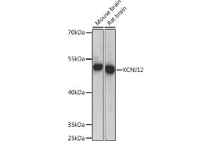Western blot analysis of extracts of various cell lines, using KCNJ12 Rabbit pAb (ABIN7269472) at 1:300 dilution. (Kir2.2 抗体  (AA 354-433))