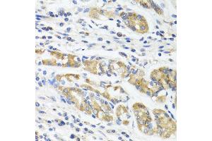 Immunohistochemistry of paraffin-embedded human stomach using IL11 antibody at dilution of 1:100 (40x lens). (IL-11 抗体)