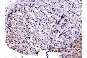 IHC analysis of MED15 using anti-MED15 antibody . (MED15 抗体  (AA 1-285))