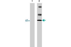 Western blot analysis of control (lane 1) and pervanadate-treated (lane 2) A-431 cells (20 ug/lane). (Neural Wiskott-Aldrich syndrome protein (WASL) (pTyr256) 抗体)