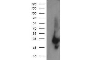 Image no. 1 for anti-RAB37, Member RAS Oncogene Family (RAB37) antibody (ABIN1500562) (RAB37 抗体)