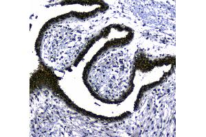 Immunohistochemistry (IHC) image for anti-STIP1 Homology and U-Box Containing Protein 1 (STUB1) (AA 51-303) antibody (ABIN5693017)