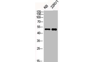 Western Blot analysis of KB 22RV1 cells using Phospho-KOR-1 (S369) Polyclonal Antibody (OPRK1 抗体  (pSer369))