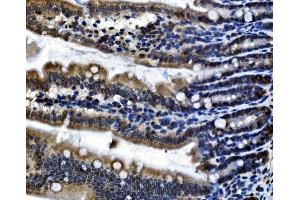 IHC analysis of CDC27 using anti-CDC27 antibody (ABIN7602163).