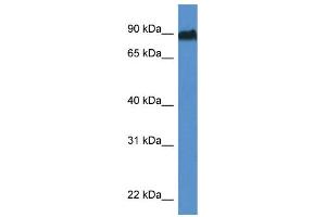 WB Suggested Anti-Sik1 Antibody   Titration: 1.