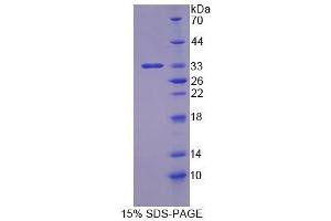 SDS-PAGE analysis of Human IHPK3 Protein. (IP6K3 蛋白)