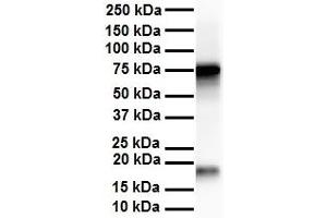 WB Suggested Anti-APEH antibody Titration: 1 ug/mL Sample Type: Human liver (APEH 抗体  (N-Term))