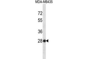 Western Blotting (WB) image for anti-Small Nuclear Ribonucleoprotein Polypeptide B (SNRPB2) antibody (ABIN2996703) (SNRPB2 抗体)
