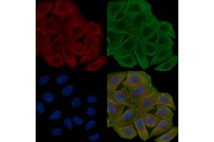 ABIN6261624 and ABIN6278152 staining Hela cells(30 min of UV treatment) by IF/ICC.