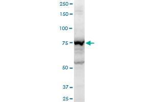 AMOT polyclonal antibody (A01), Lot # 060613JCS1. (Angiomotin 抗体  (AA 361-460))