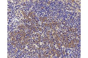 Immunohistochemistry analysis of paraffin-embedded mouse spleen using CD284 Polyclonal Antibody at dilution of 1:1000. (TLR4 抗体)