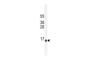SG11A Antibody (N-term) (ABIN654791 and ABIN2844469) western blot analysis in NCI- cell line lysates (35 μg/lane). (SPAG11A 抗体  (N-Term))