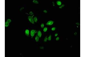 Immunofluorescent analysis of A549 cells using ABIN7163478 at dilution of 1:100 and Alexa Fluor 488-congugated AffiniPure Goat Anti-Rabbit IgG(H+L) (PIWIL4 抗体  (AA 12-235))
