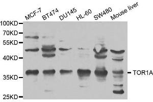 Western blot analysis of extracts of various cell lines, using TOR1A antibody. (TOR1A 抗体)