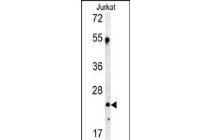 Western blot analysis of C1QA antibody in Jurkat cell line lysates (35ug/lane) (C1QA 抗体  (C-Term))