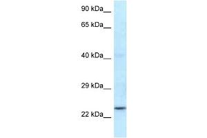 WB Suggested Anti-Rnf141 Antibody Titration: 1. (RNF141 抗体  (N-Term))