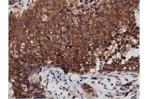 Image no. 8 for anti-DnaJ (Hsp40) Homolog, Subfamily A, Member 2 (DNAJA2) antibody (ABIN1497858)