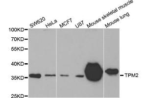 Western blot analysis of extracts of various cell lines, using TPM2 antibody. (TPM2 抗体)