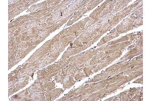 Immunohistochemistry (IHC) image for anti-Calcium/calmodulin-Dependent Protein Kinase II delta (CAMK2D) antibody (ABIN2856806)