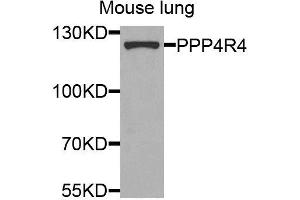 Western blot analysis of extracts of mouse lung, using PPP4R4 antibody (ABIN5974913) at 1/1000 dilution. (PPP4R4 抗体)