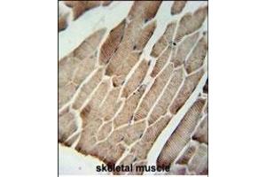 Immunohistochemistry (Paraffin-embedded Sections) (IHC (p)) image for anti-Solute Carrier Family 9, Subfamily A (NHE9, Cation Proton Antiporter 9), Member 9 (SLC9A9) (AA 551-579), (C-Term) antibody (ABIN651604)