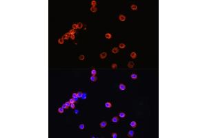 Immunofluorescence analysis of R.