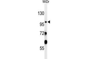 Western Blotting (WB) image for anti-Vacuolar Protein Sorting 52 Homolog (VPS52) antibody (ABIN3002120) (VPS52 抗体)