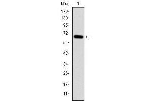 Western blot analysis using MAP3K2 mAb against human MAP3K2 (AA: 148-359) recombinant protein.