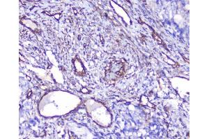 IHC analysis of INPPL1 using anti-INPPL1 antibody (ABIN6719492). (INPPL1 抗体  (AA 1172-1258))