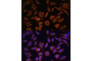 Immunofluorescence analysis of L929 cells using 14-3-3 alpha/beta antibody (ABIN3021284, ABIN3021285, ABIN3021286 and ABIN6214397) at dilution of 1:100. (YWHAB 抗体  (AA 1-246))