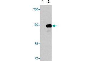 Western blot analysis of UPF1 (arrow) using UPF1 polyclonal antibody . (RENT1/UPF1 抗体  (AA 7-37))