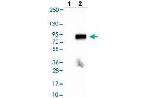 Western blot analysis of Lane 1: Negative control (vector only transfected HEK293T lysate), Lane 2: Over-expression lysate (Co-expressed with a C-terminal myc-DDK tag (~3. (Tyrosinase-Related Protein 1 抗体  (AA 257-377))