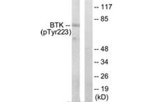 Western blot analysis of extracts from HeLa cells treated with Serum 10% 15', using BTK (Phospho-Tyr223) Antibody. (BTK 抗体  (pTyr223))