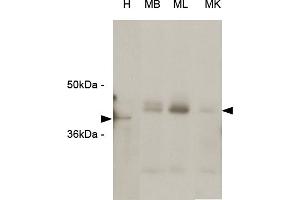 Western blot analysis The extracts of HeLa (H) cells , mouse brain (MB), mouse liver (ML) and mouse kidney (MK) tissues (each 20 ug) were resolved by SDS-PAGE, transferred to PVDF membrane and probed with anti-human RASSF1A (1:1000). (RASSF1 抗体  (Isoform A, N-Term))