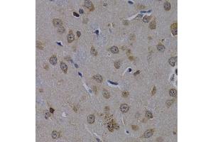 Immunohistochemistry (IHC) image for anti-Polymerase (RNA) II (DNA Directed) Polypeptide L, 7.6kDa (POLR2L) (AA 1-67) antibody (ABIN3023304)